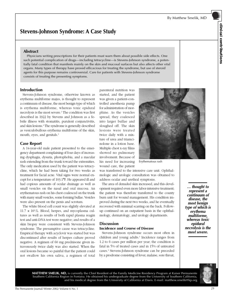 Stevens-Johnson Syndrome: A Case Study: Erythematous Rash | PDF