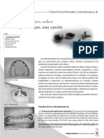 vdocuments.site_sobredentaduras-a-pernos-tapa-o-ataches-en-bola.pdf