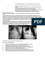 caso clinico tuberculosis