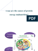 Causes of protein energy malnutrition PEM