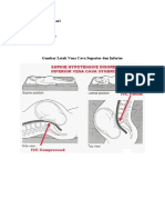 VENA CAVA SUPERIOR INFERIOR