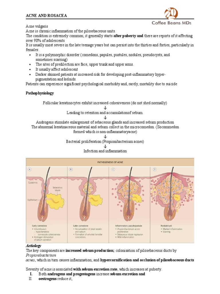 Acne and Rosacea: Aetiology | PDF | Cutaneous Conditions | Dermatology