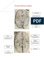 8.1 MORFOLOGÍA INTERNA DEL CEREBRO.pdf