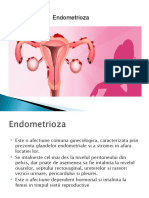 endometrioza