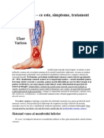 Ulcer varicos.pdf
