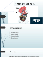 Arritmia Cardíaca