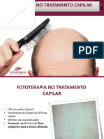 Fototerapia no tratamento capilar