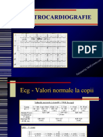 ECG-perfectionare-Released-by-MedTorrents.com.ppt