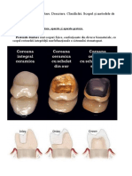 Proteze_dentare__Descriere_-16801.docx