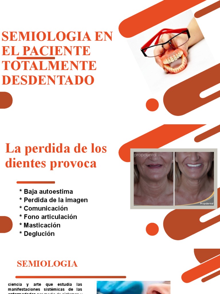 Caracterización clínica del paciente totalmente edéntulo y factores a ...