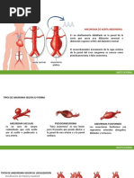 ANEURISMA DE AORTA ABDOMINAL