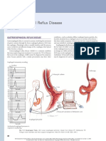 Gastroesophageal Reflux Disease PDF