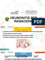 Neumonitis Por Radiaciones