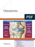 Osteoartritis