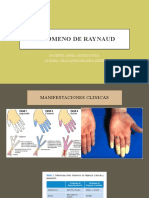 FENOME DE RAYNAUD