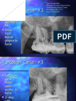 Roots Furcation Canal