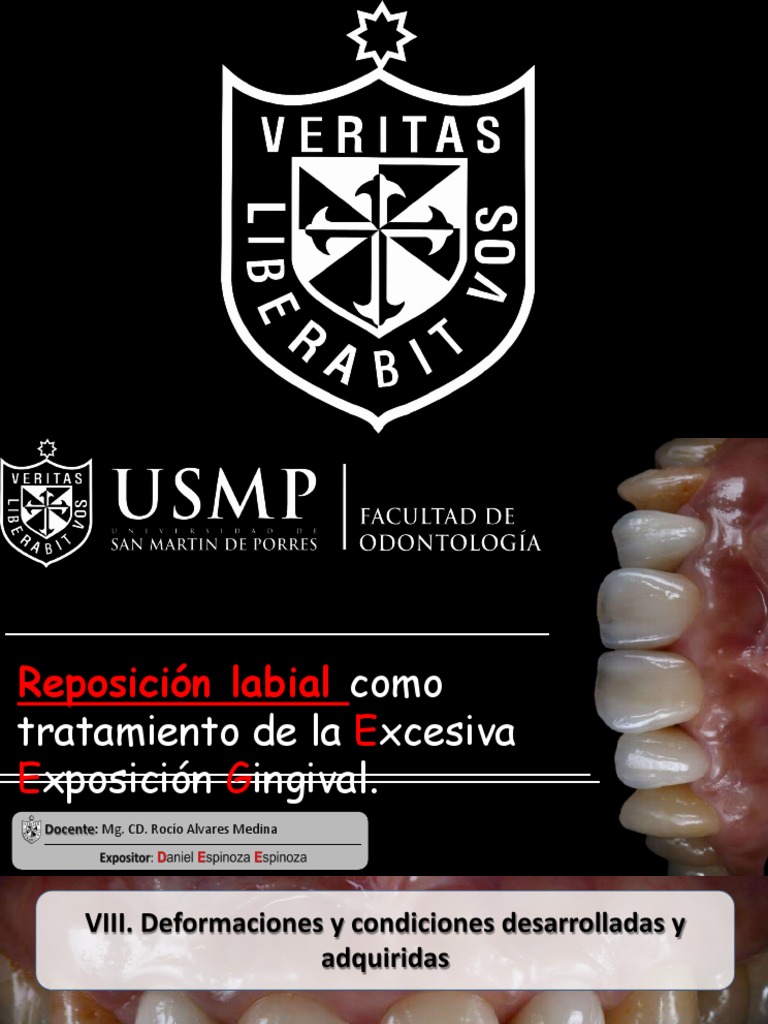 Reposición Labial y Exposición Gingival | PDF | Encía | Boca