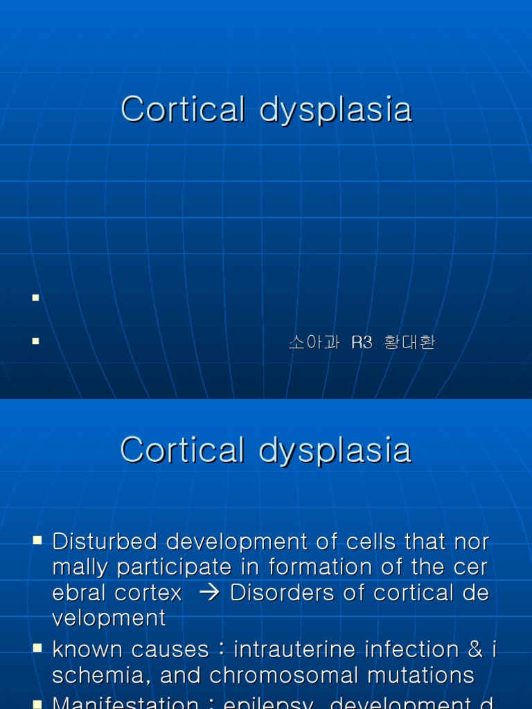Corticaldysplasiareview | PDF | Cerebral Cortex | Human Diseases And ...
