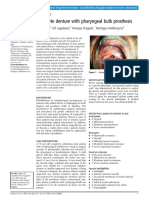 Naveen Et Al. - 2013 - Complete Denture With Pharyngeal Bulb Prosthesis