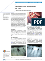 Naveen Et Al. - 2014 - Alternatives For Restoration of A Hemisected Mandibular Molar