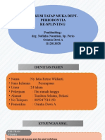 DTM Perio Splinting