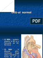 EKG-ul normal-