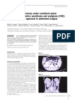 Right Open Nephrectomy Under Combined Spinal and Peridural Operative Anesthesia and Analgesia (CSE) : A New Anesthetic Approach in Abdominal Surgery