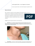Hipertiroidismul: Care Sunt Afectiunile Asociate Glandei Tiroide - Cauze, Diagnostic Si Tratament