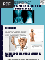 Análisis del Ángulo Lumbosacro y Ferguson | PDF | La columna vertebral ...