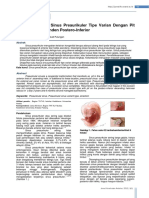 Penatalaksanaan Sinus Preaurikuler Tipe Varian Dengan Pit pada Heliks Desenden Postero-Inferior.pdf