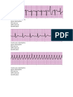 ECG Examples For Midterm Winter 09-10