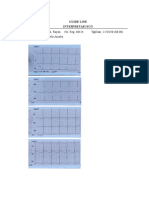 Interpretasi Ecg