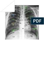 Chest X-ray details