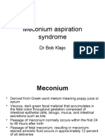 Meconium Aspiration Syndrome: DR Bob Klajo