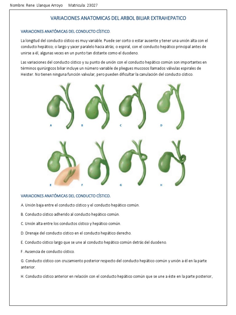 Variantes Anatómicas del Conducto Cístico | PDF | Vesícula biliar ...
