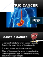 Gastric-cancer-and-Pancreatic