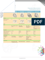 Diagnostico Diferencial de La Cardiomiopatia Restrictiva