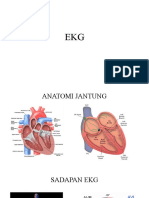 EKG