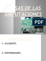 PPW CAUSAS DE AMPUTACION