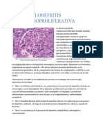 glomerulonefritis membranoproliferativa  