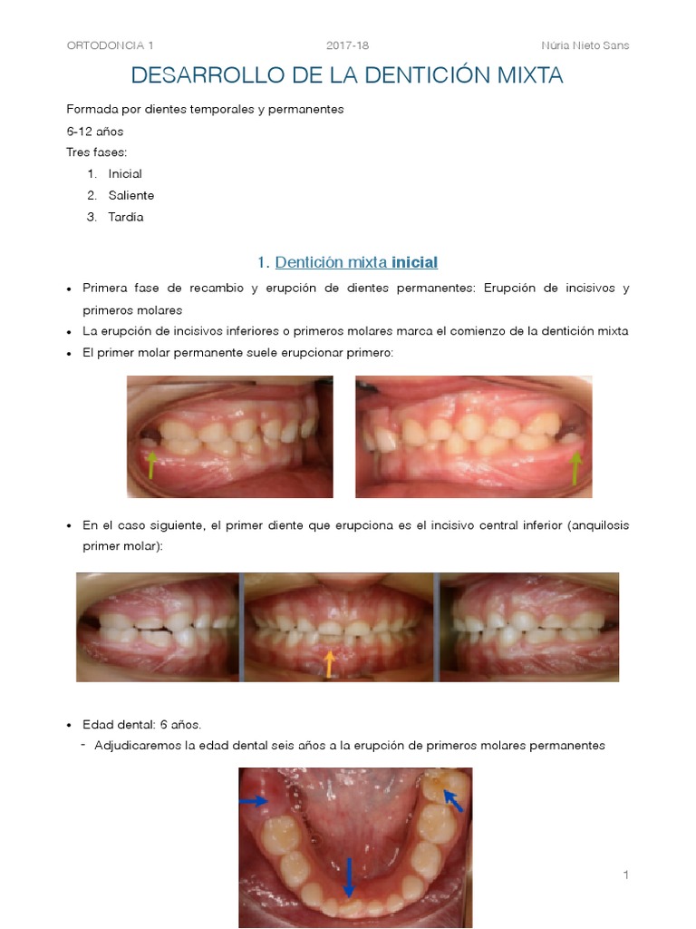 Tema 5. Desarrollo de La Dentición Mixta 19.10.17 | PDF | Ortodoncia ...