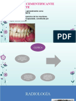 Fibroma Cementificante Osificante