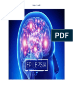 Proceso Epilepsia