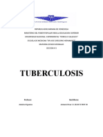 TUBERCULOSIS