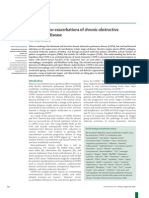 New drugs for exacerbations of chronic obstructive