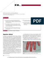 Mehu131_U1_T2_Artículo  Psoriasis.pdf