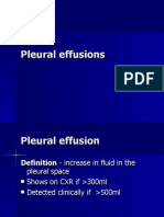 Causes and Types of Pleural Effusions