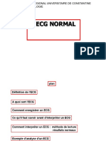 Cardio4an TD Ecg Normal