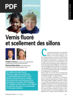 Vernis Fluoré Et Scellement Des Sillons