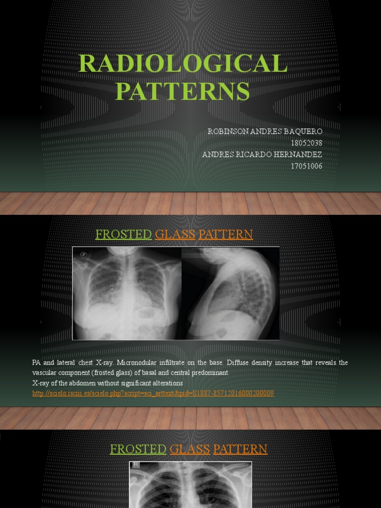 Radiological Patterns in Chest X-rays | PDF | Lung | Medical Specialties